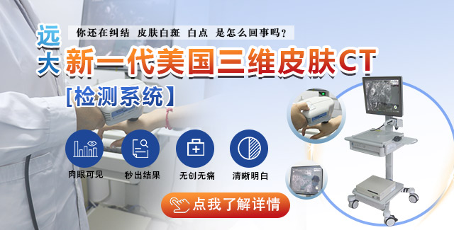 石家庄白癜风直播