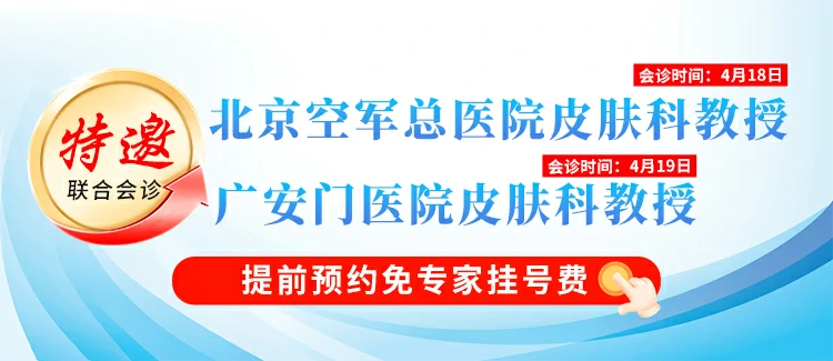 石家庄专治白癜风医院